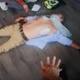 Image of individidual receiving CPR